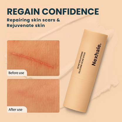 Nexhale™ Scar Stick Refined (1.4 fl.oz)