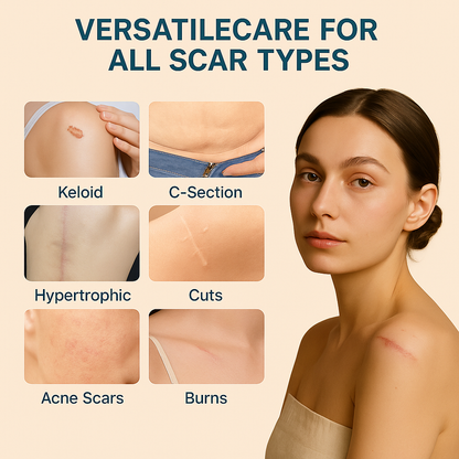 Nexhale™ Scar Stick Refined (1.4 fl.oz)